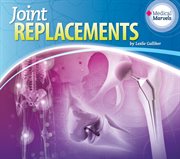 Joint replacements cover image