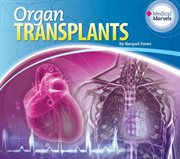 Organ transplants cover image