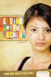 Living with acne cover image