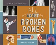 All About Broken Bones cover image