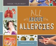 All About Allergies : Inside Your Body cover image