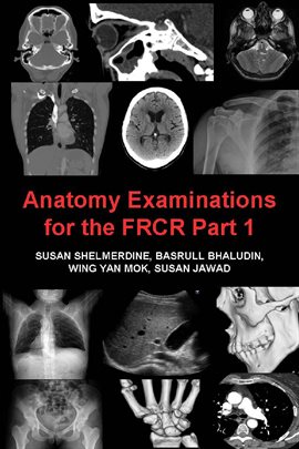 Cover image for Anatomy Examinations for the FRCR Part 1