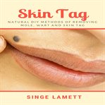 Skin tag : natural diy methods of removing mole, wart and skin tag cover image