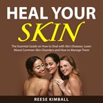 Heal your skin cover image