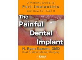 Cover image for The Painful Dental Implant