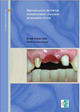 Cover image for Reconstrucción de dientes endodonciados