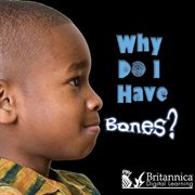 Why Do I Have Bones? cover image