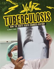 Tuberculosis : how the white death changed history cover image