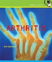 Arthritis cover image
