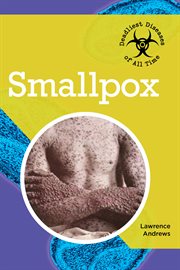 Smallpox cover image