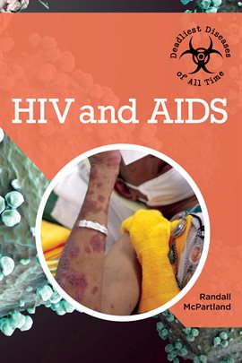 Cover image for HIV and AIDS
