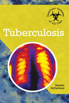 Cover image for Tuberculosis