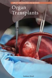 Organ transplants cover image