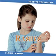 Rashes cover image