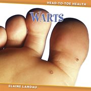 Warts cover image