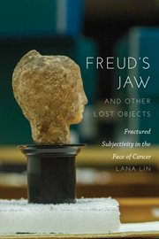 Freud's jaw and other lost objects : fractured subjectivity in the face of cancer cover image