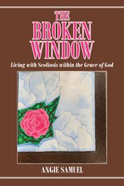 The broken window. Living with Scoliosis within the Grace of God cover image