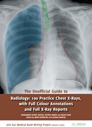 The unofficial guide to radiology : 100 practice chest x-rays, with full colour annotations and full x-ray reports cover image