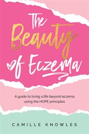 The beauty of eczema : a guide to living a life beyond eczema using the HOPE principles cover image