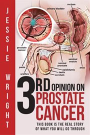 3rd opinion on prostate cancer cover image