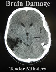 Brain Damage cover image