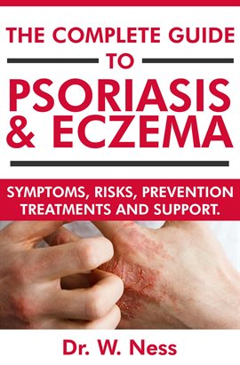 Cover image for The Complete Guide to Psoriasis & Eczema: Symptoms, Risks, Prevention, Treatments & Support