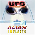 Ufo chronicles: alien implants cover image