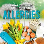 What you need to know about allergies cover image