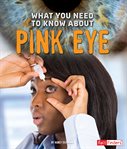 What you need to know about pink eye cover image