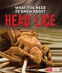 What you need to know about head lice cover image