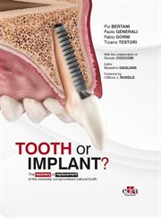 Tooth or Implant? cover image