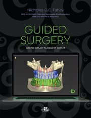 Guided Surgery : Making Implant Placement Simpler cover image