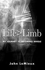 Life is greater than limb : my journey to becoming whole cover image