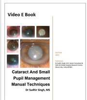 Cataract and small pupil management manual techniques cover image
