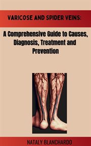 Varicose and Spider Veins: A Comprehensive Guide to Causes,Diagnosis, Treatment and Prevention : a comprehensive guide to causes, diagnosis, treatment and prevention cover image