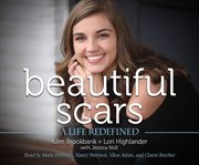 Beautiful scars cover image
