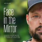 Face in the Mirror : A Surgeon, a Patient, and the Remarkable Story of the First Face Transplant at Mayo Clinic cover image
