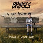 Bruises cover image