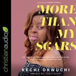 More than my scars : the power of perseverance, unrelenting faith, and deciding what defines you cover image