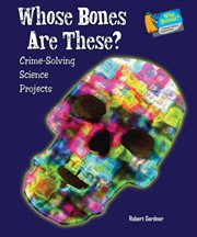 Whose bones are these? : Crime-Solving Science Projects cover image