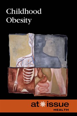 Cover image for Childhood Obesity
