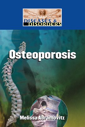 Image de couverture de Osteoporosis