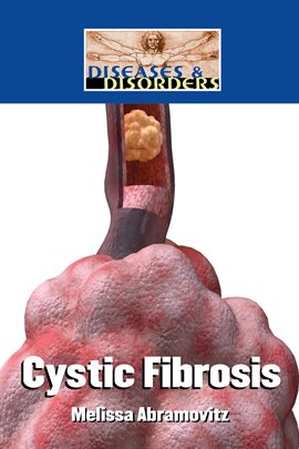 Cover image for Cystic Fibrosis