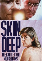 Skin deep. The Battle Over Morgellons cover image