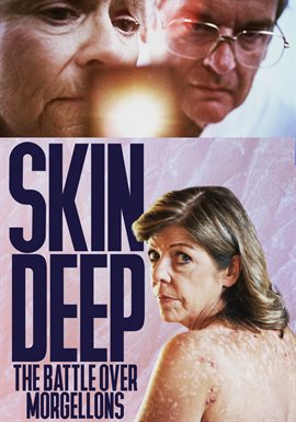 download the deep skin