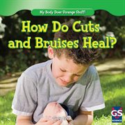 How do cuts and cruises heal? cover image