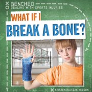 What If I Break a Bone? cover image