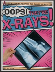 Oops! they're x-rays! cover image