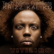 Vitiligo cover image