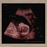 Too asleep to hear the massive wind blow cover image